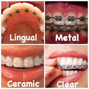 Orthodontic treatment